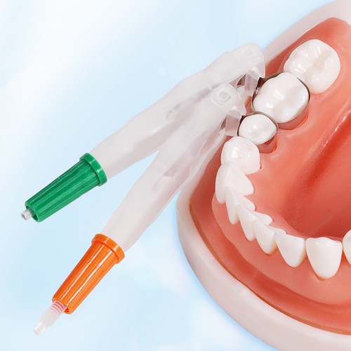 Sistema de restauración de metal de bandas de matriz seccionales dentales ajustables de 2 tipos - Imagen 5 de 10