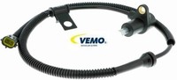 Vemo V53-72-0045 Sensor FüR Raddrehzahl ABS Sensor Raddrehzahl FüR Kia