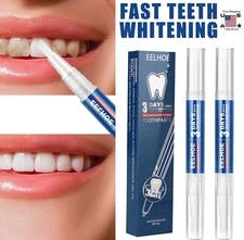 Teeth Whitening Gel Pen Extra Strong White Hygiene Tooth Whitener Stain Removal