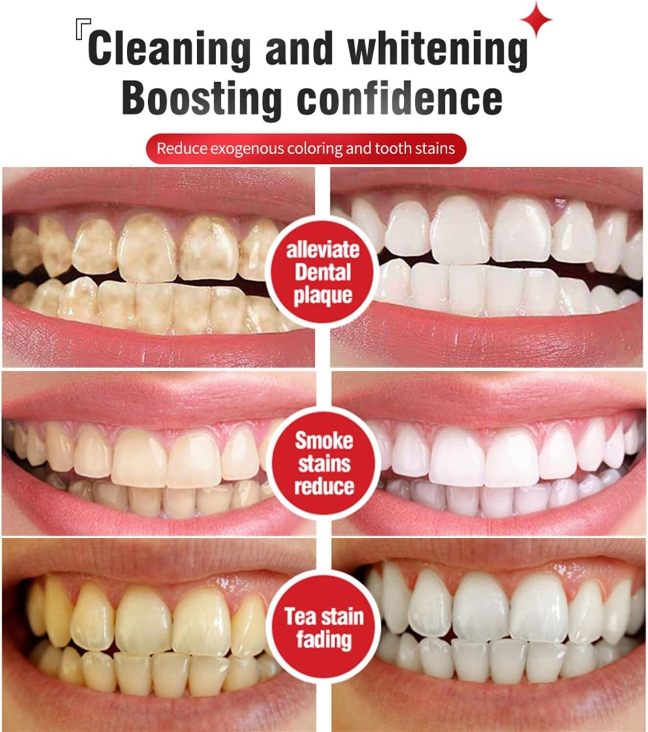 2Pcs Super Probiotic SP-6 Toothpaste, Probiotics Bright White Toothpaste, Sp 6