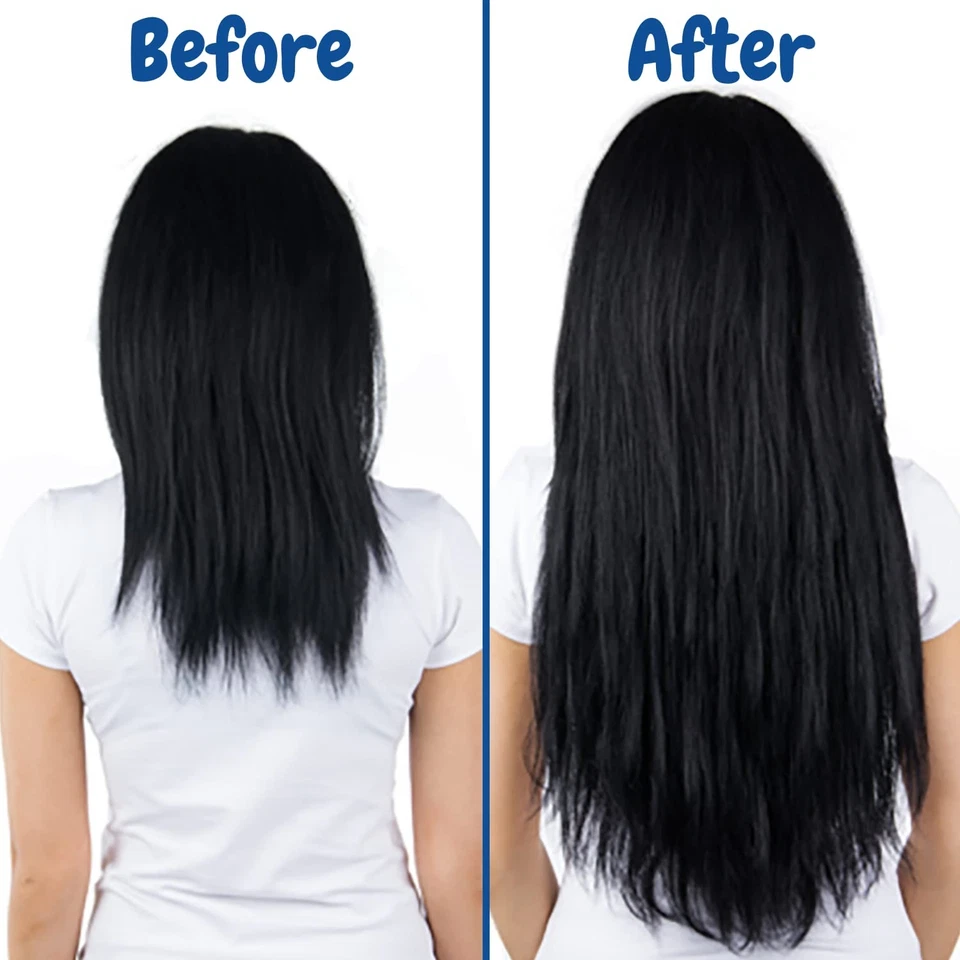 Verseo Sup Hair Growth Conditioner Treatment | for  - Image 3 of 4