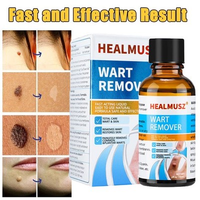 HEALMUSZ Wart Remover Liquid Plantar Wart Removers for Feet Body Fast Acting