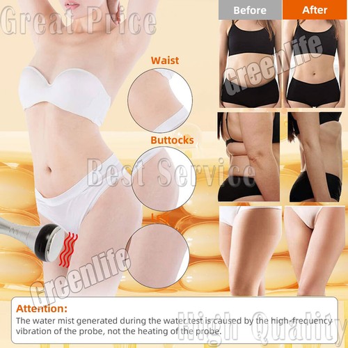 Massaggiatore dimagrante terapia luce rossa R-F brucia cellulite corpo e viso 40k - Foto 15 di 18