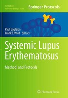 Paul Eggleton (U. A.) | Systemic Lupus Erythematosus | Taschenbuch | Englisch