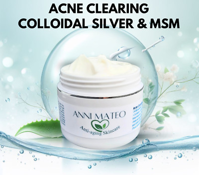Anti-inflammatory & anti-bacterial Acne & spots Clearing Cream with MSM Silver