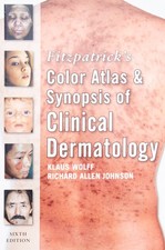 Fitzpatrick's Color Atlas and Synopsis of Clinical Dermatology: Sixth Editio...