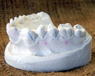Vintage Plaster Dental Mould Human Teeth Anatomy Medical Dentist Abnormality #10