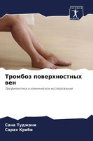 Sana Tudzhani (U. A.) | Tromboz Powerhnostnyh Wen | Taschenbuch | Russisch