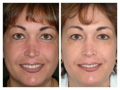 MicroDermabrasión Crema Cristales Exfoliante Anti Envejecimiento Arrugas Rejuvenecimiento Exfoliante Foto 3 de 4