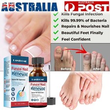 ANTI FUNGAL NAIL REPAIR LIQUID INFECTION ANTIBACTERIAL TREATMENT TOE FINGER TOOL