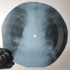 BEATLES PENNY LANE X-Ray USSR Record Roentgen Bone Ribs Music Vinyl