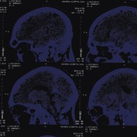 The Nightingales - Mind Over Matter Cd Neu
