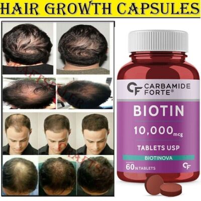Extra Strength Hair Growth Vitamin for Women Men Fast - (60 Tablets)