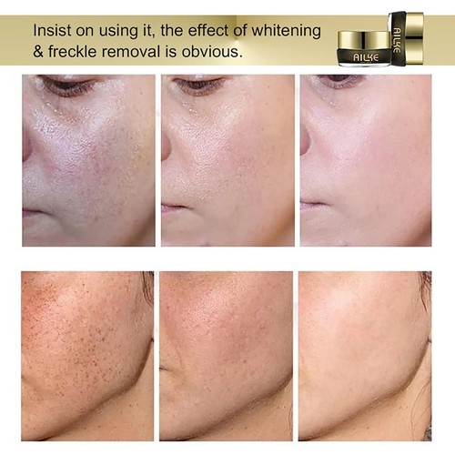 Whitening Face Cream And Serum Reduce Dark Spots Collagen Niacinamide Glutathion - Picture 6 of 12