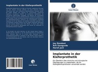 Implantate In Der Kieferprothetik Jay Dondani
