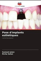 Pose D'implants EsthéTiques L'art Et La Science Sumeet Jalan (U. A.) Taschenbuch