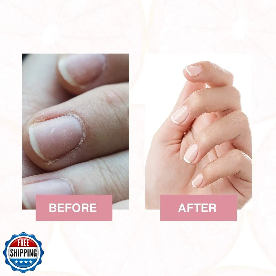 Gena Mani Spa Liquid Hand Soak | Softens, Moisturizes Hands, Nails, and Cutic - Image 3 of 4