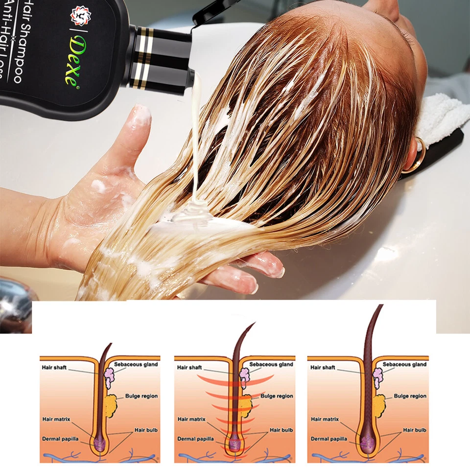 Hair Growth Shampoo Hair Regrowth Treatment Anti-Hair Loss Shampoo For Men Women - Image 4 of 4