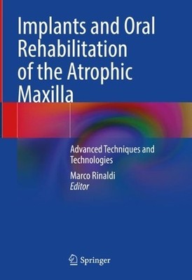 Implants and Oral Rehabilitation of the Atrophic Maxilla - 9783031127540