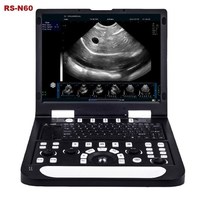 RS-N60 Full Digital PC Processing System Veterinary Ultrasonic Diagnostic Device