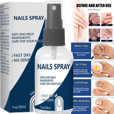 Blinzador Nails Spray Fingernails Nutrition Long-Lasting Toenail Care Supplies