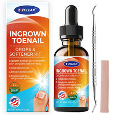 Ingrown Toenail Relief: Ingrown Toenail Tool for Men Women - Ingrown Toenail Rem