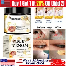 Bee Venom Skin Tag Removal Treatment Cream Body Care Mole Corn Wart Remover