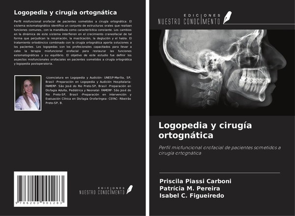 Priscila Piassi Carboni (U. A.) | Logopedia Y CirugíA OrtognáTica | Taschenbuch-image