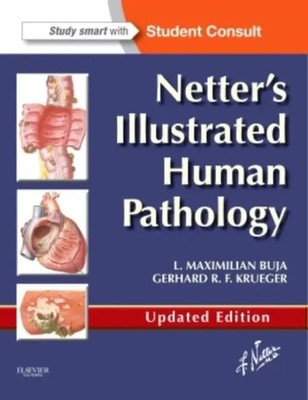Netter's Illustrated Human Pathology Updated Edition | Krueger (u. a.) | Buch
