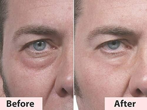 Thin Lizzy Puffy Eye Remover, Cruelty Free Undereye Cream Elminates Puffiness... - Picture 4 of 4