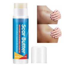 Scar Removal Cream Repair Stick Fade Stretch Markers Burns Treatment 20g