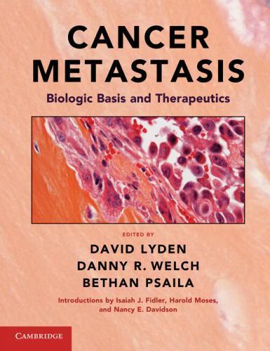Cancer Metastasis : Biologic Basis and Therapeutics by Danny R. Welch (2011, ...