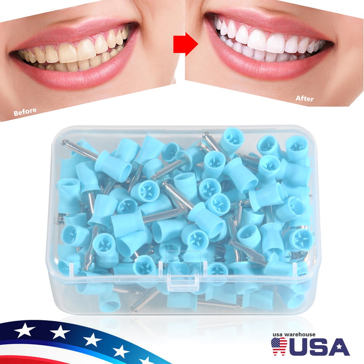 1000 Dental-Prophy-Becher – Polierbecher Latch-Typ Für Zahnarztpraxen