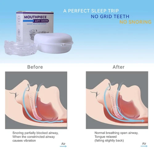 New 2025 Anti-Snoring Mouthpiece with Adjustable Mouth Guard for Comfortable Use - Picture 5 of 11