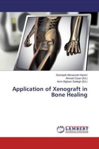 Thumbnail - Application Of Xenograft In Bone Healing 5540