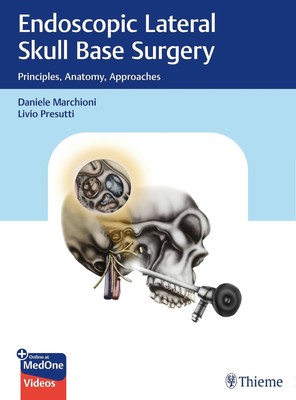 Daniele Marchioni ~ Endoscopic Lateral Skull Base Surgery 9783132412774