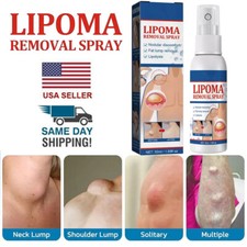 50ML Lipomheilung Reduction Spray, Instant LumpFree Lipoma Removal Spray USA Hot