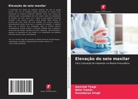 ElevaçãO Do Seio Maxilar Aanchal Tyagi