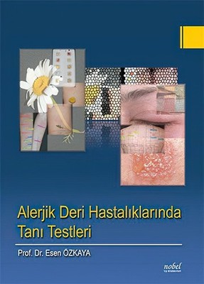 Alerjik Deri Hastalıklarında Tanı Testleri - Diagnostic Skin Tests - Turkish