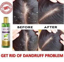 New Natural Ayurveda Shampoo For Dandruff And Hair Fall Get 100 Result FS
