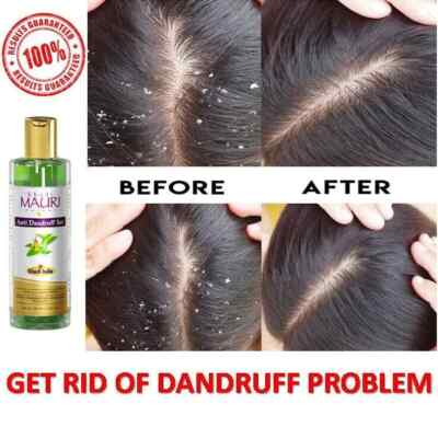 New Natural & Ayurveda Shampoo For Dandruff And Hair Fall Get 100% Result FS