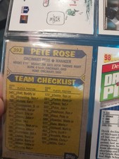 1987 Topps Pete Rose Cincinnati Reds #393 RARE ERROR Baseball Card