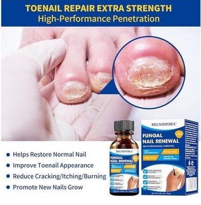 Mejor Tratamiento Para Los Hongos En Las Uñas De Los Pies Dedos Cura Hongos