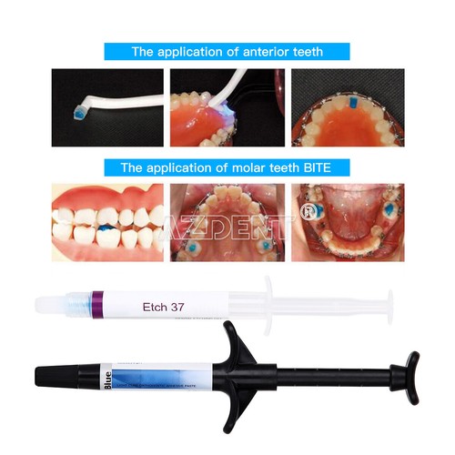Adhesivo de fotocurado para ortodoncia dental para brackets brackets - Imagen 10 de 32