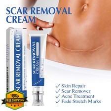 Scar Cream Gel Removal Surgical Stretch Marks Keloid Bump Treatment 1pcs