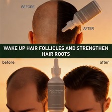 Deoxyribose Sugar Gel Hair Growth, Deoxyribose Serum for Hair Loss 60ml USA