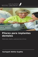 Pilares Para Implantes Dentales Garlapati Akhila Guptha