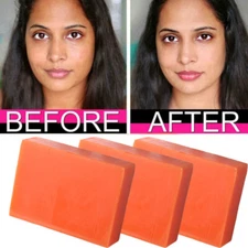 3/2PCS Kojic Acid Soap Dark Spot Whitening Face Body Bleaching Skin Lightening
