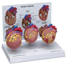 Heart 3-pc Mini-Heart Anatomical Model Set GPI LFA 2550 SeeVIDEO Make an Offer