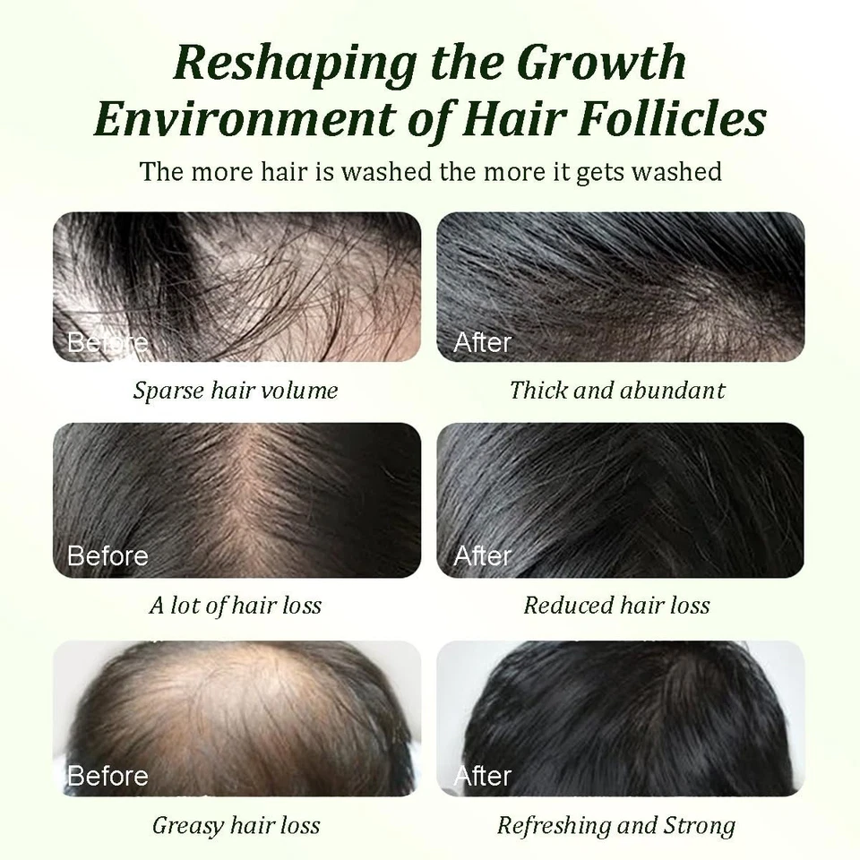 Batana Oil Shampoo Hair Growth, Strengthening, Thickening, Sulfate Free - 300ml - Image 4 of 4